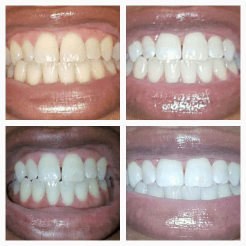 Dual-Action Whitening Serum